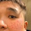 你一肘子