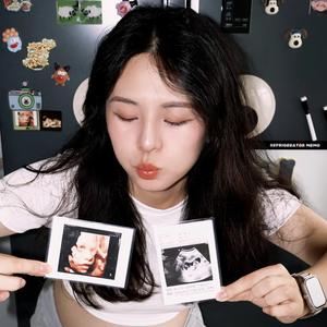 567滴ma（孕晚期）头像