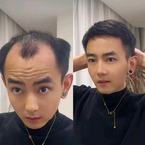 苏州东哥⭐假发⭐补发🉑上门头像